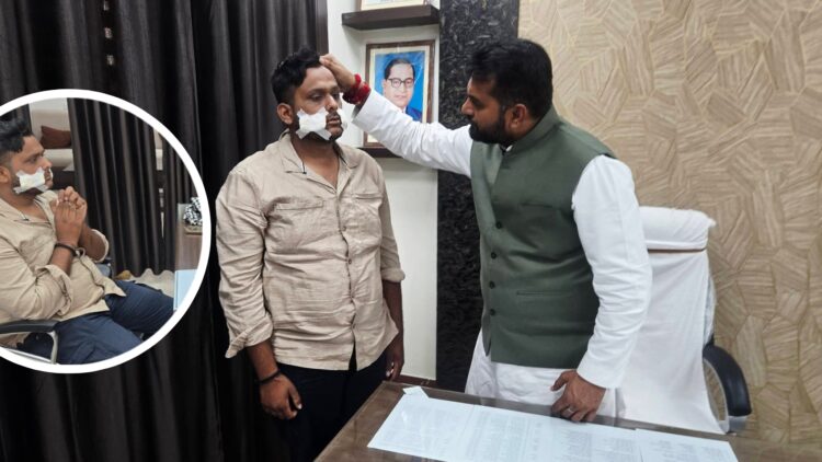 रायपुर में चाइनीज मांझे का तांडव: युवक का चेहरा बुरी तरह कटा, चेहरे पर आए 35 टांके 😭